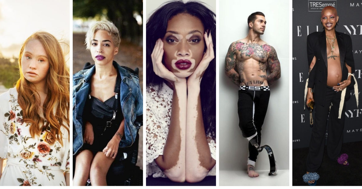 5 Unusual Supermodels Who Are Unique In Their Own Ways